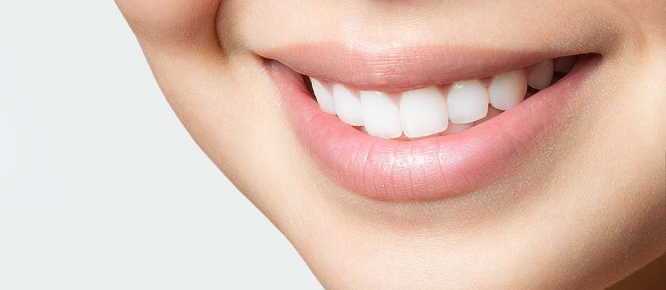 teeth whitening singapore dentist